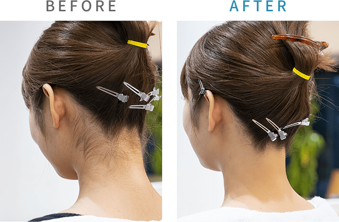 before after