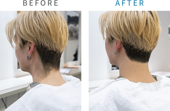 before after