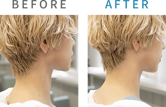 before after