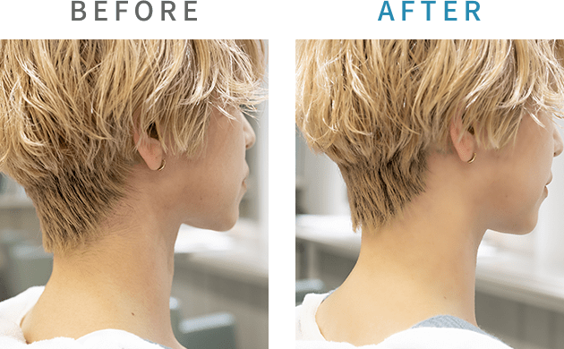 before after