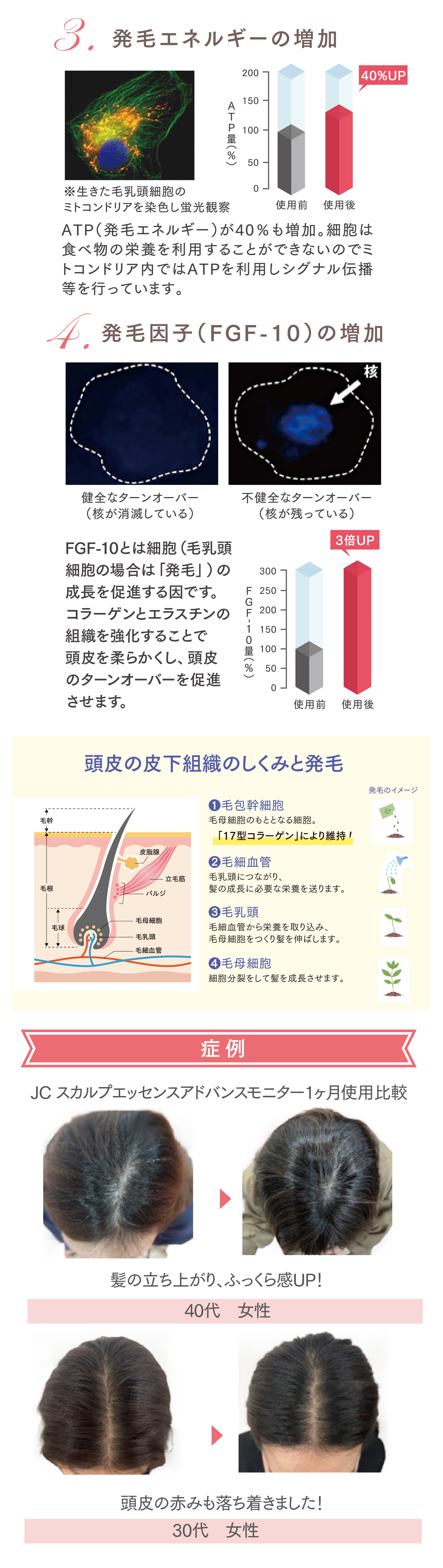 JC スカルプエッセンスアドバンス 100ｍL