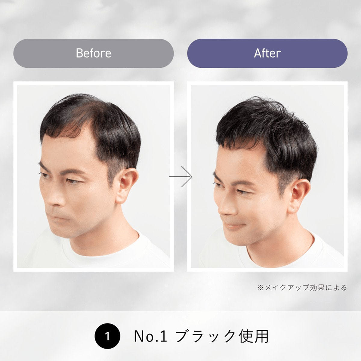 スーパーミリオンヘアー コンパクトセット No1ブラック(10g/15ml)の卸