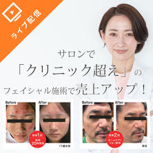 サロンで「クリニック超え」のフェイシャル施術で売上アップ！