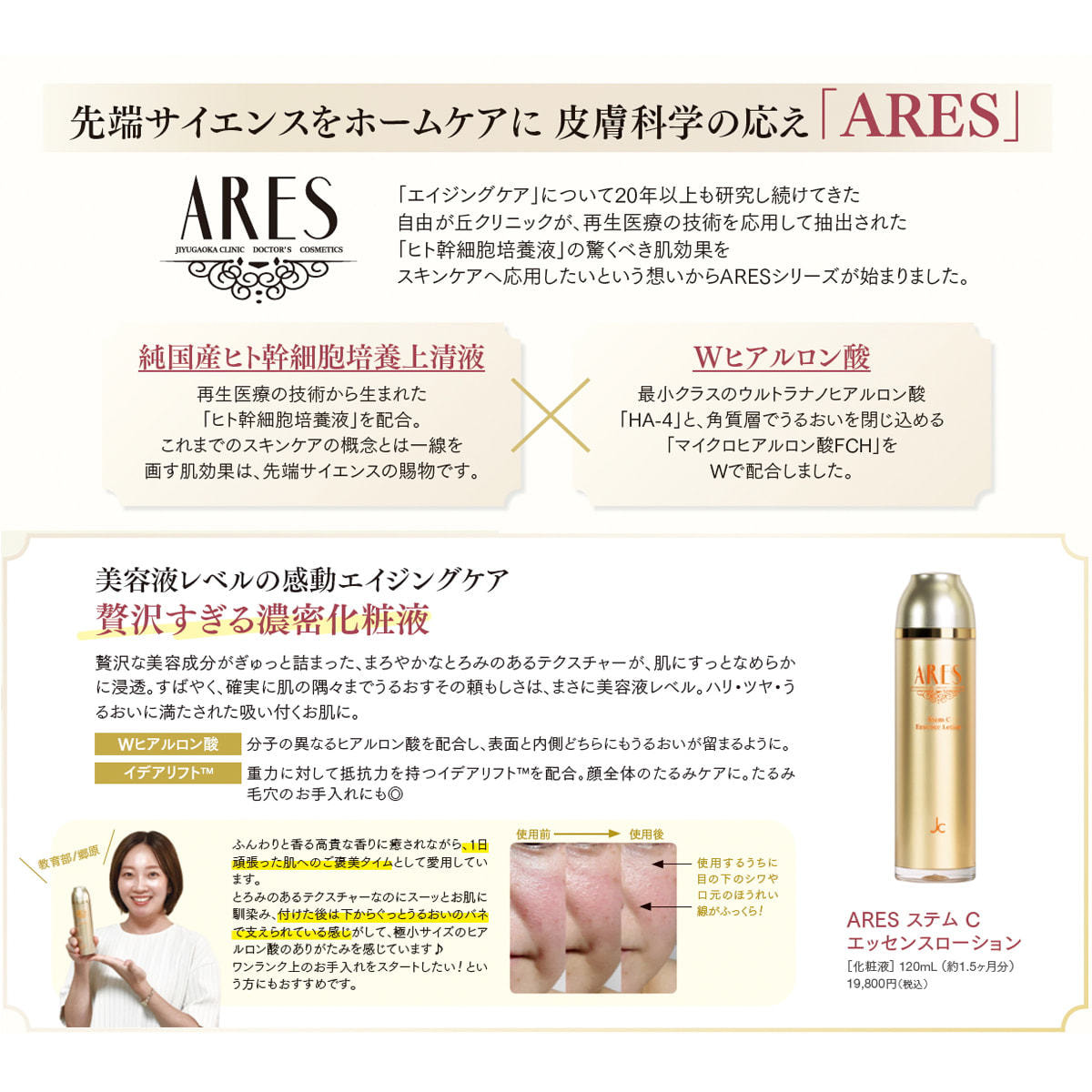 ARES ステムC エッセンスローション 120ml【2mlパウチ×5枚付】の卸