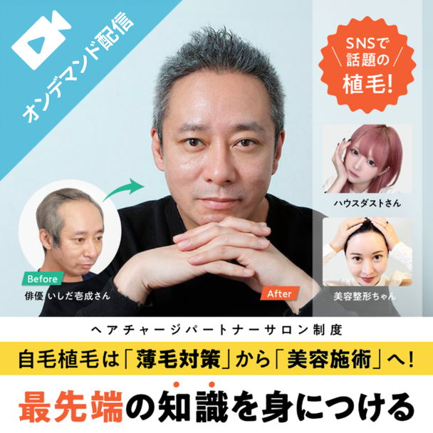 美容ニーズで急拡大！自毛植毛（ヘアチャージ）無料オンライン説明会 1
