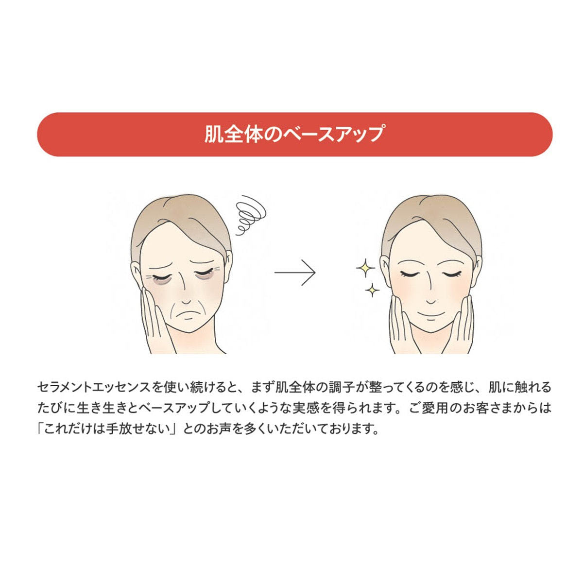 CONC セラメントエッセンス Gen2 30mlの卸・通販 | ビューティガレージ