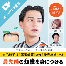 美容ニーズで急拡大！自毛植毛（ヘアチャージ）無料オンライン説明会