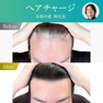 美容ニーズで急拡大！自毛植毛（ヘアチャージ）の基礎知識と新メニュー提案セミナー 4
