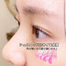 【Flap eyelashes】シェルロッド 5サイズセット 8